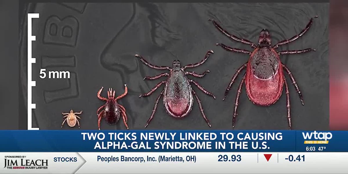 Bite Alpha Map Two ticks newly linked to causing Alpha-Gal Syndrome in the United States